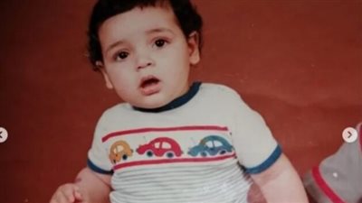 هذا الطفل أصبح من أشهر مطربين جيله أصيب بمرض جلدي لا يوجد له علاج.. من هو؟