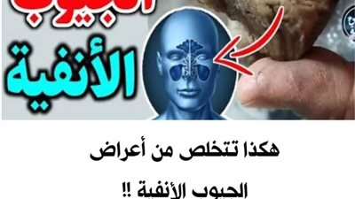 هكذا تتخلص من أعراض الجيوب  